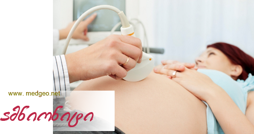 ამნიონიტი