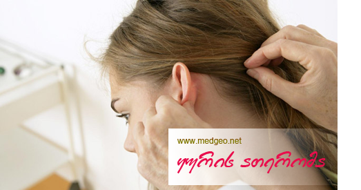 ყურის ათერომა