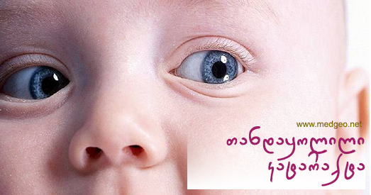 თანდაყოლილი კატარაქტა