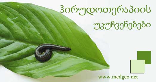 ჰირუდოთერაპიის-უკუჩვენებები