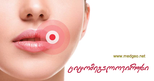 ციტომეგალოვირუსი